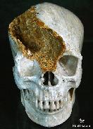 Huge 4.9" Coral Fossil Carved Crystal Skull, Super Realistic